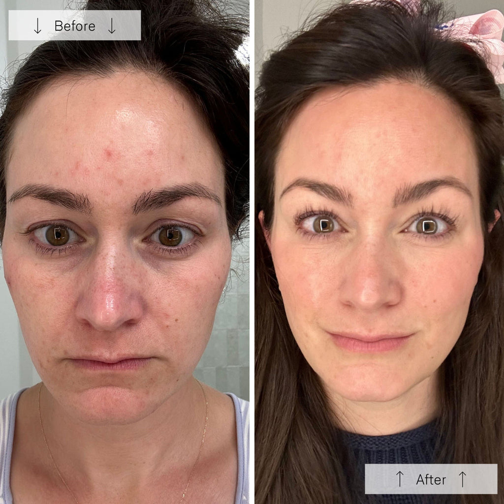 NYC™ Anti-Aging