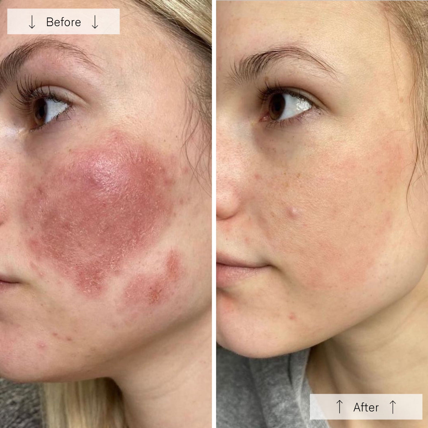 NYC™ Anti-Aging