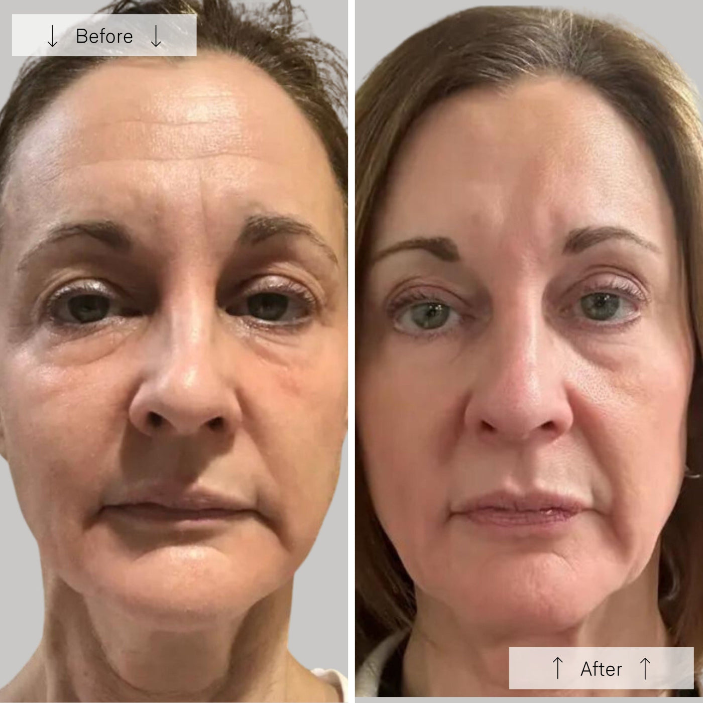 NYC™ Anti-Aging