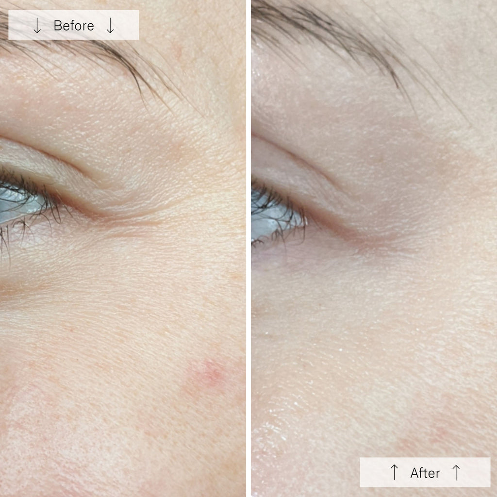 NYC™ Anti-Aging